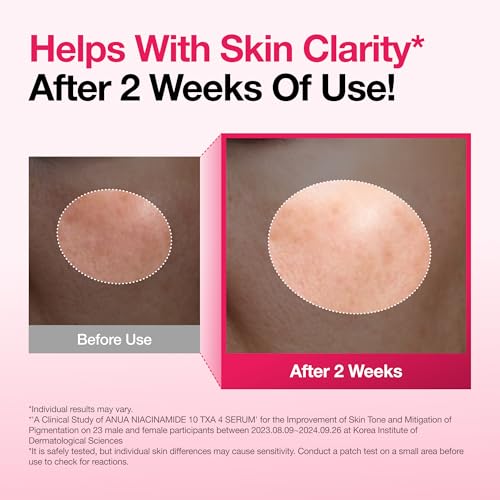 ANUA NIACINAMIDE10% + TXA 4% DARK SPOT REMOVING SERUM